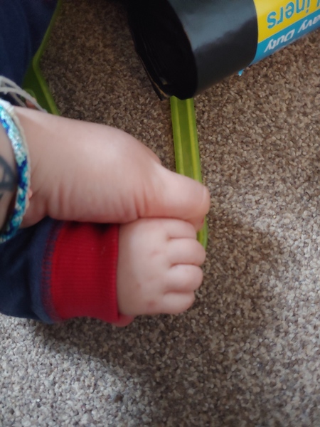 9 month old with deep dimples everywhere.