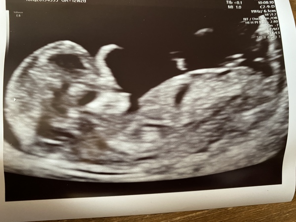 Do you want me to guess the sex? 12 week scans.