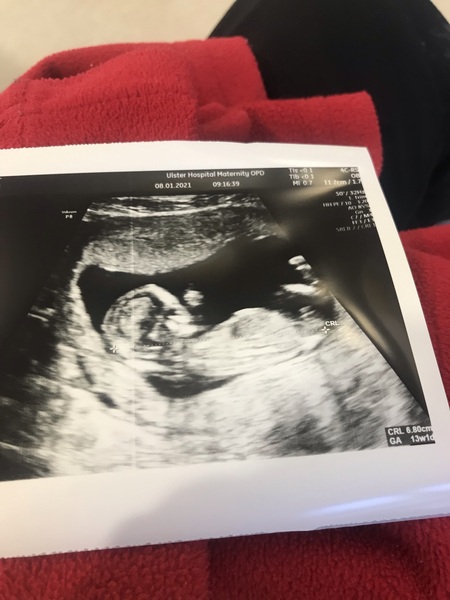 Do you want me to guess the sex? 12 week scans.