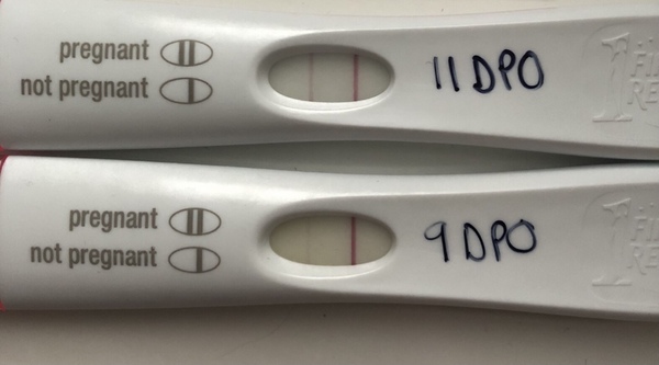 When to do a FRER?