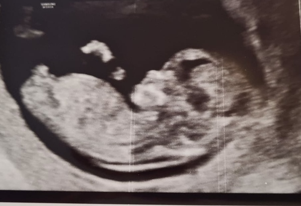 Boy or girl? Finding out tonorrow!