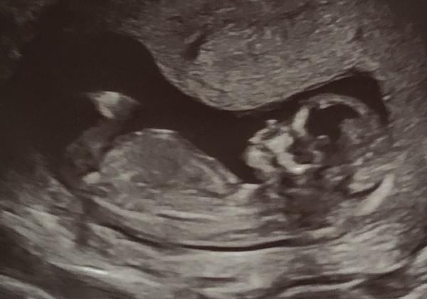 Gender Guesses please!