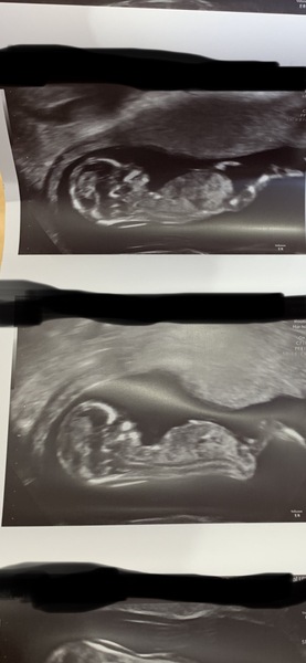 Gender help please
