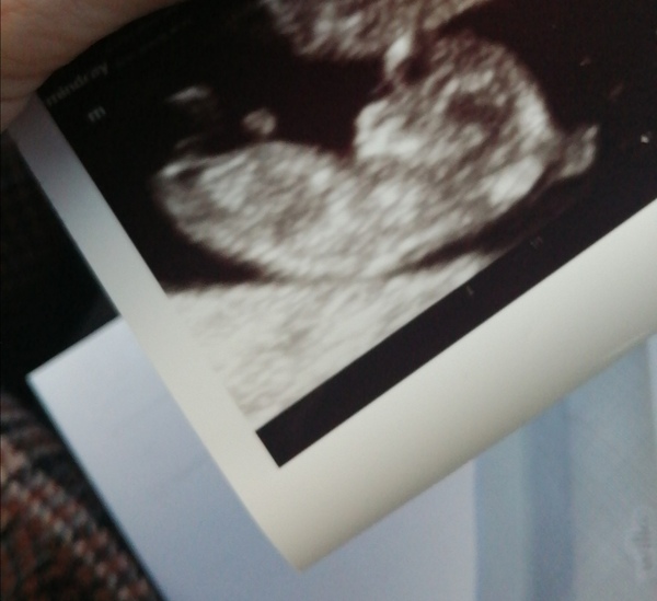 4 weeks today!