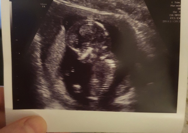 4 weeks today!