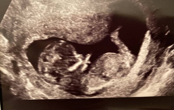Gender guesses? I can’t see nub! 😂😂