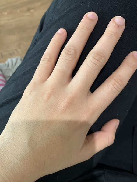 Does anyone want to play 'guess the age of my hands?