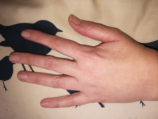 Does anyone want to play 'guess the age of my hands?