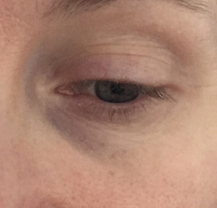 Eye Cream recommendations