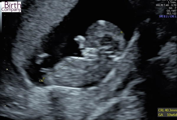 August 2021 - Scans and booking in!