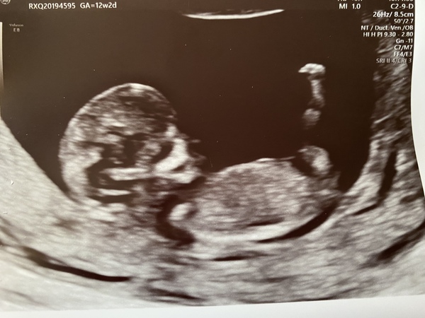 Do you want me to guess the sex? 12 week scans.