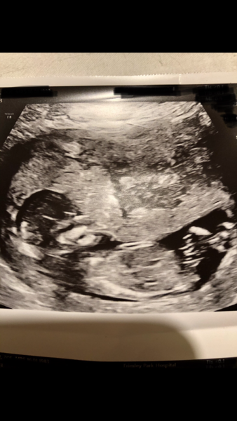 Gender guess please!