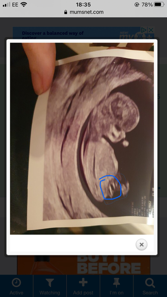 Nub theory- I don't understand can someone show me?