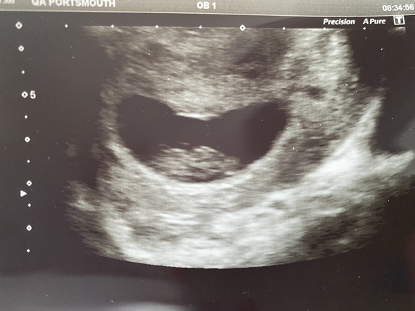 3x Due Aug 21 consolidated