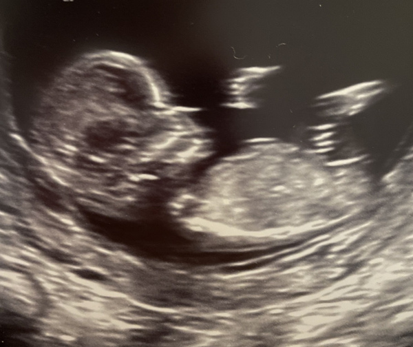 Do you want me to guess the sex? 12 week scans.
