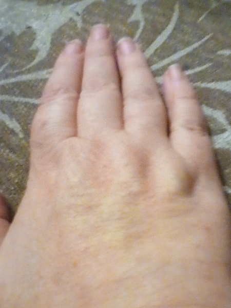 Does anyone want to play 'guess the age of my hands?
