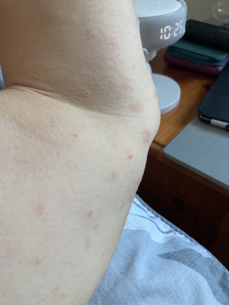 Any skin experts about? Please can you tell me what this is?