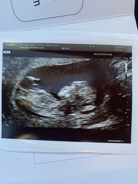 August 2021 - Scans and booking in!