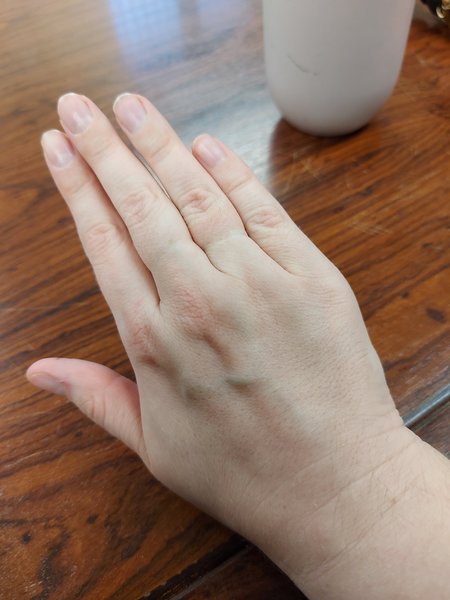 Does anyone want to play 'guess the age of my hands?