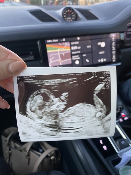 Do you want me to guess the sex? 12 week scans.
