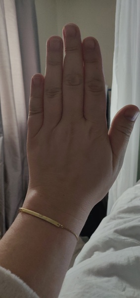 Does anyone want to play 'guess the age of my hands?