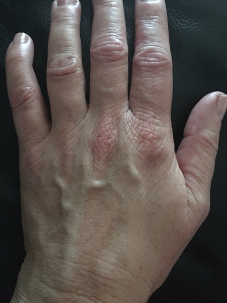 Does anyone want to play 'guess the age of my hands?