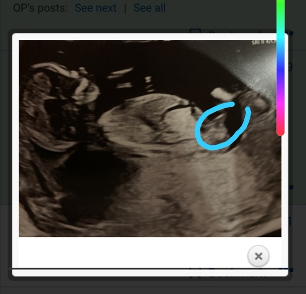 Nub theory - I think girl?