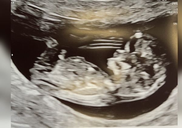 Gender guess!