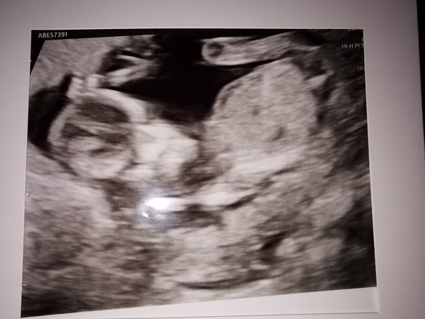 IVF graduates due Summer 2021