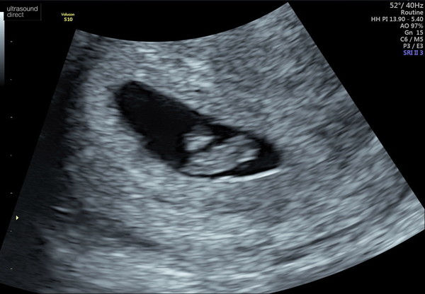 BFP - due August 2021