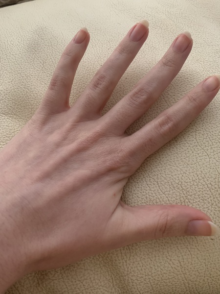 Does anyone want to play 'guess the age of my hands?