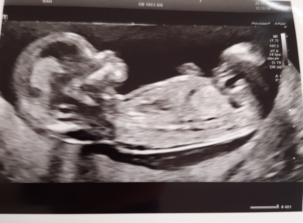 Any gender guesses please