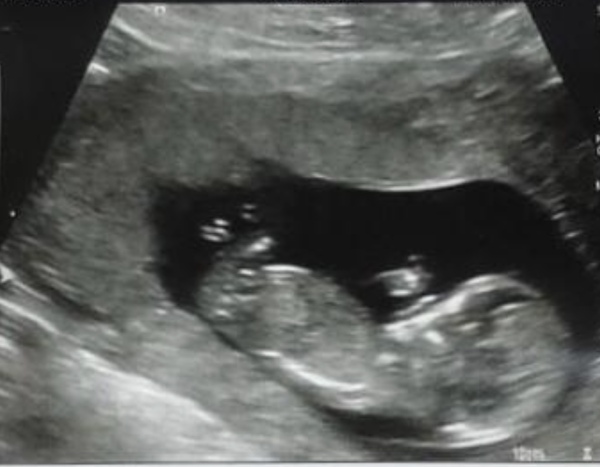 Do you want me to guess the sex? 12 week scans.