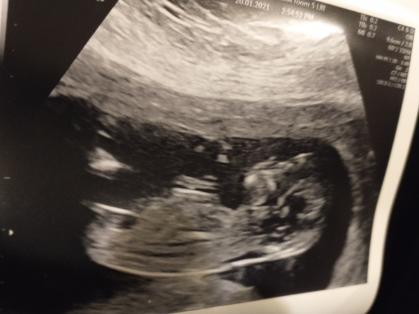 July/August 2021! Second babies
