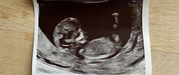 July/August 2021! Second babies