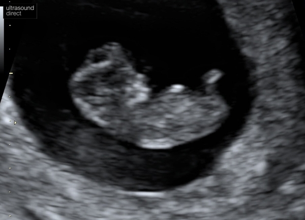 August 2021 - Scans and booking in!