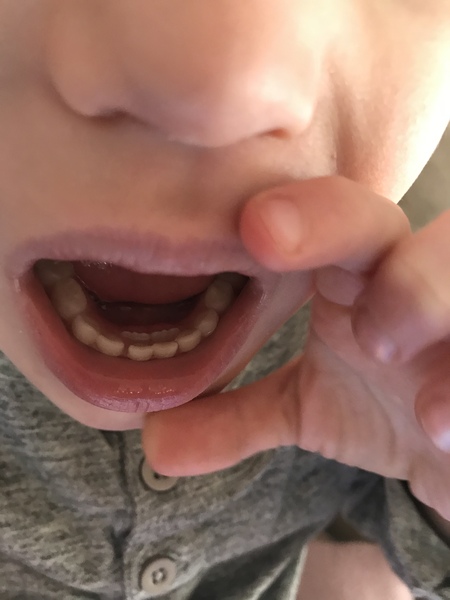 Shark teeth