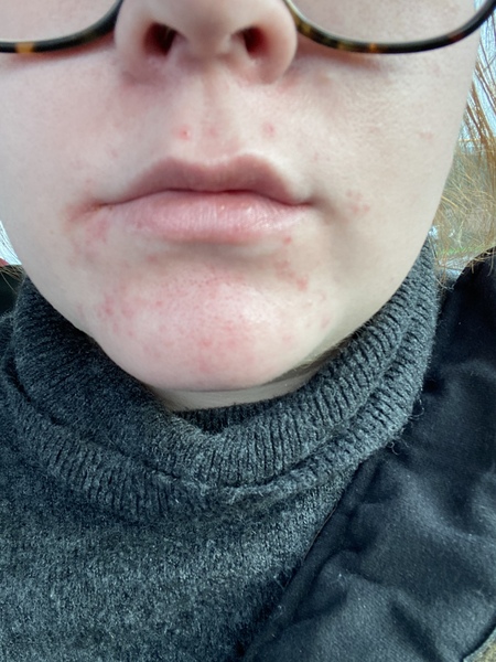 To ask for help with hormones? (TMI)