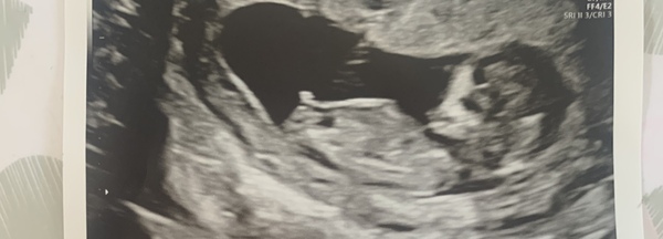 Nub Theory?! Boy or Girl?!