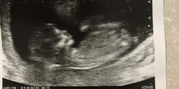 Do you want me to guess the sex? 12 week scans.