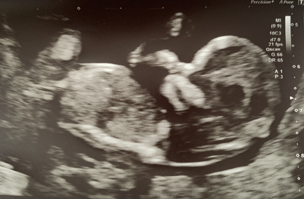 Gender guess!