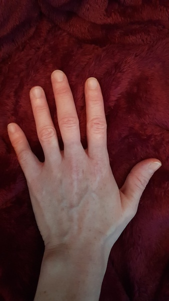 Does anyone want to play 'guess the age of my hands?