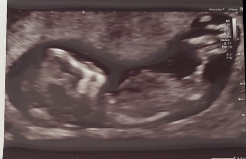Scan