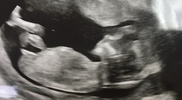Gender guess - very clear nub?