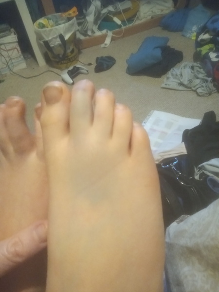 Anyone been to children's A&E recently