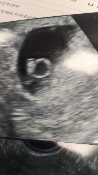 BFP - due August 2021