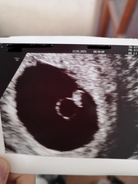 September 2021 thread 2🥳
