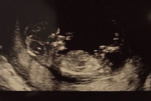 Do you want me to guess the sex? 12 week scans.
