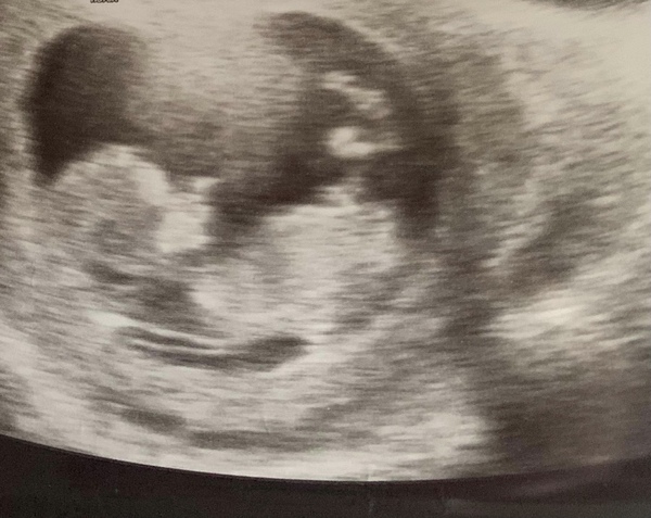 Eeeeeek first baby! Boy or girl?