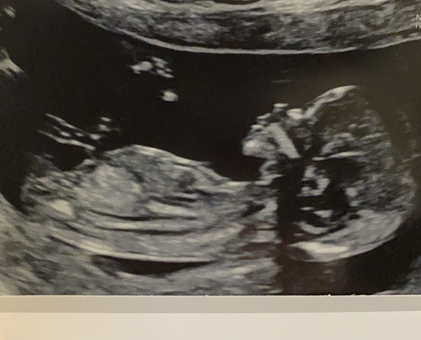 Any guesses? Girl or Boy?
